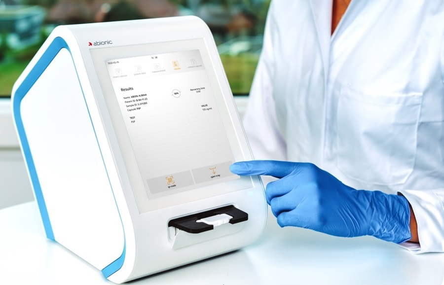 Image: The IVD CAPSULE PSP test PSP runs on the abioSCOPE near-patient rapid diagnostic platform (Photo courtesy of Abionic)