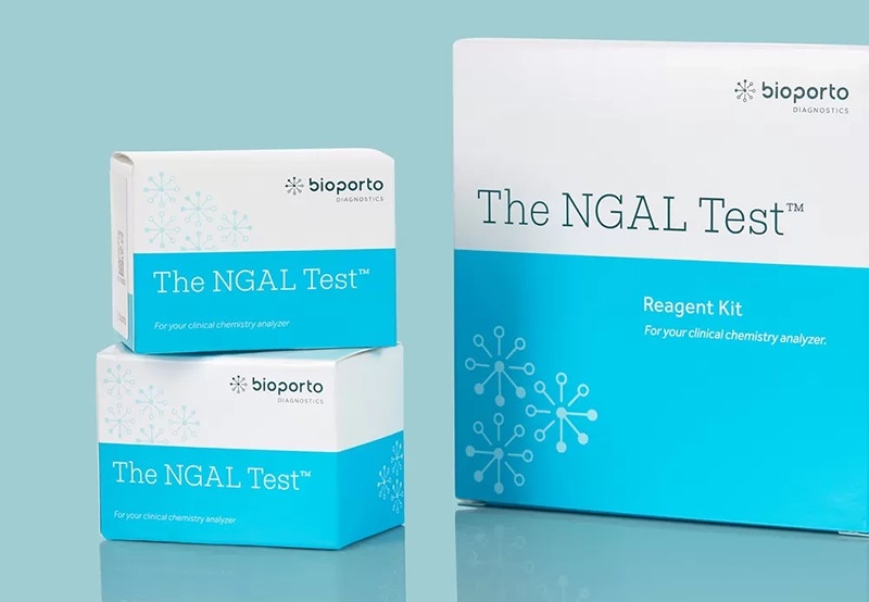 Image: The NGAL Test quantifies NGAL levels in human urine, EDTA and heparin plasma (Photo courtesy of BioPorto)