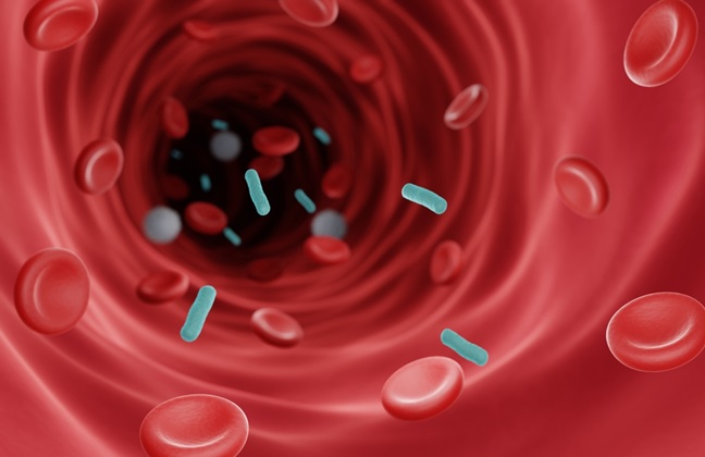 Image: HNL Dimer can be a novel and potentially useful clinical tool in antibiotic stewardship in sepsis (Photo courtesy of Shutterstock)