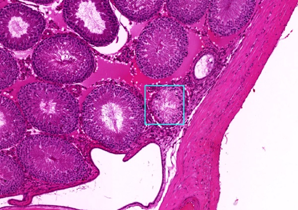 Image: The deep learning AI model can sometimes catch signs of disease that human pathologists miss (Photo courtesy of Eric Nilsson, Skinner Laboratory, WSU)