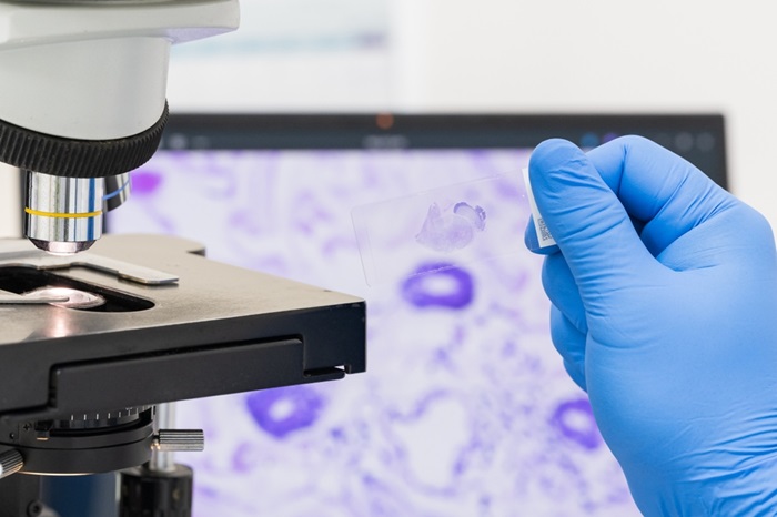 Image: Researchers have used an AI model to automate cancer pathology reports (Photo courtesy of Shutterstock)