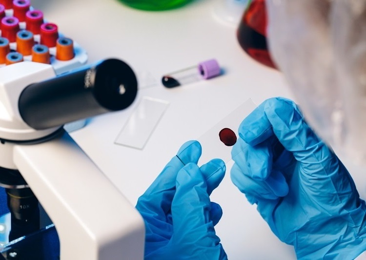 Image: An AI-powered blood test is the first to spot the earliest sign of breast cancer (Photo courtesy of 123RF)