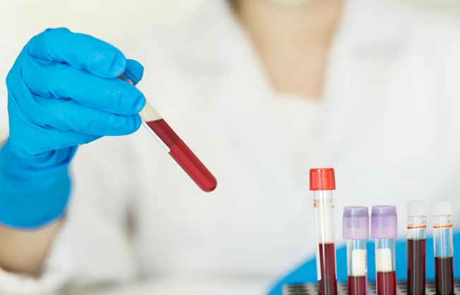 Image: Blood-based biomarkers could be a cost-effective, accurate and non-invasive diagnostic tool for dementia (Photo courtesy of Alzheimer\'s Society)