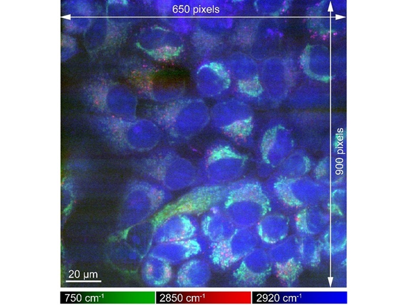 Image: Raman image of rapidly frozen HeLa cells with high signal-to-noise ratio and large field-of-view (Photo courtesy of Sci. Adv. 10, eadn0110 2024)