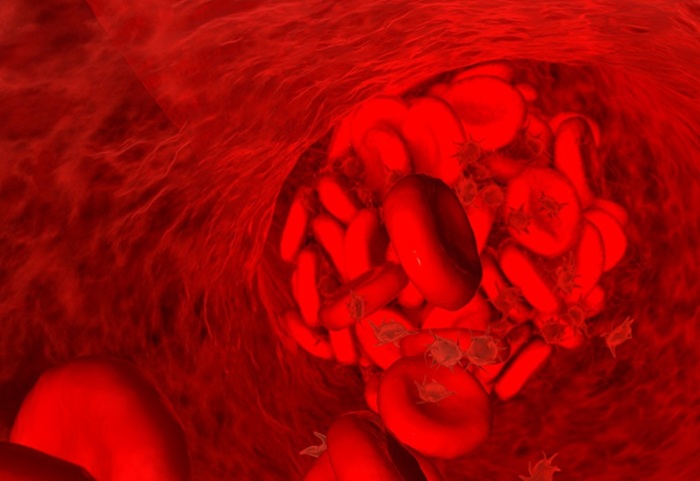 Image: The study examined the diagnostic utility of ELISA testing for heparin-induced thrombocytopenia (Photo courtesy of 123RF)