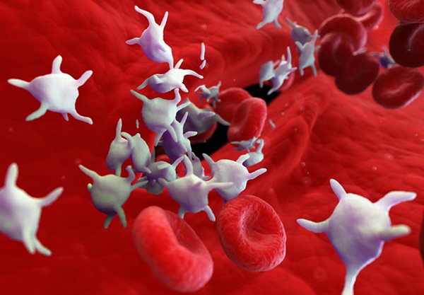 Image: The high precision platelet counting technology reduces risks that can lead to errors in cancer diagnoses (Photo courtesy of Adobe Stock)