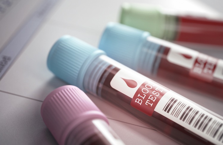 Image: A simple blood test could transform how asthma is identified and monitored (Photo courtesy of 123RF)