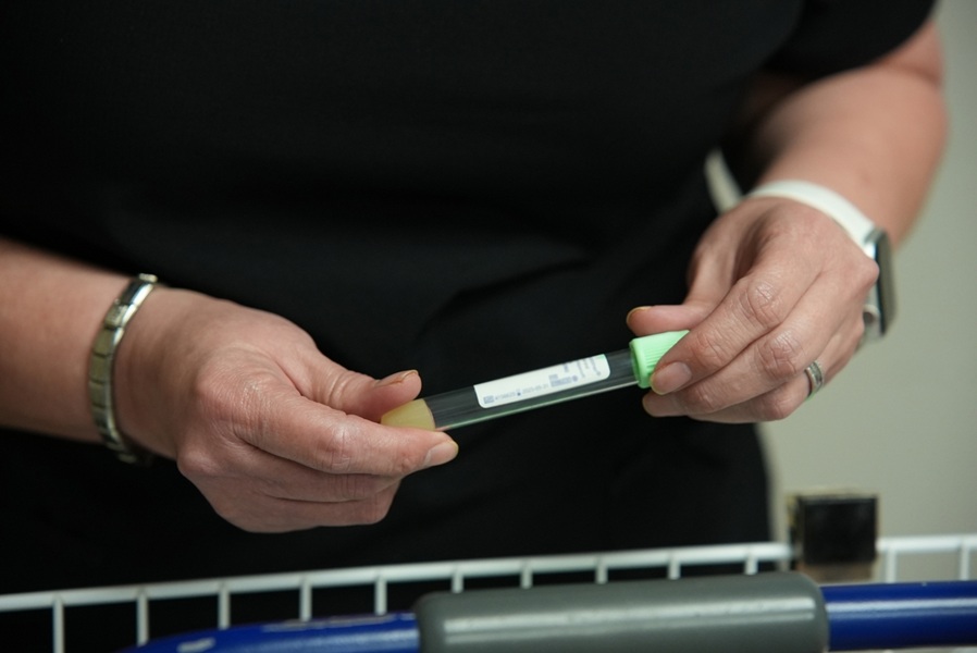 Image: The blood test to detect stroke type before hospital arrival can allow faster treatment (Photo courtesy of American Heart Association)