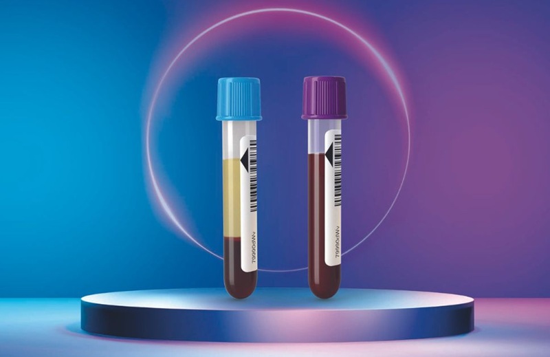 Image: BloodScience Workcell offers hematology and hemostasis testing in one interdisciplinary solution (Photo courtesy of Sysmex)