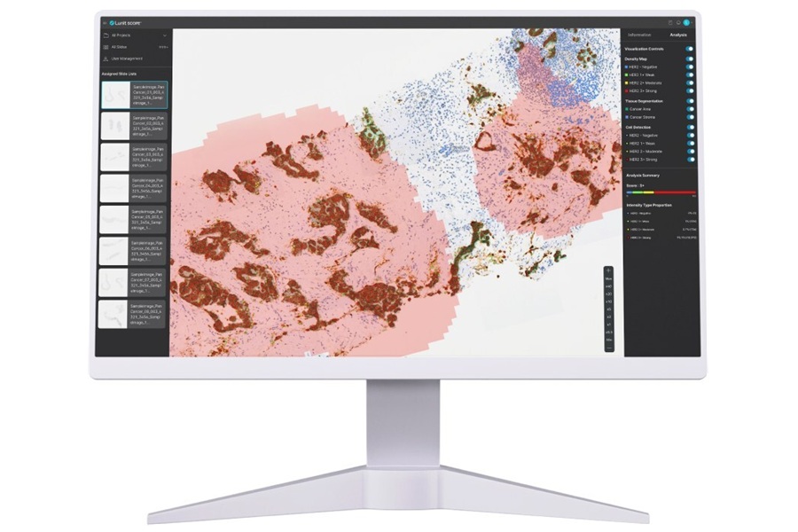 Image: Lunit SCOPE HER2 is an AI-powered solution designed to detect HER2 expression profile (Photo courtesy of Lunit)