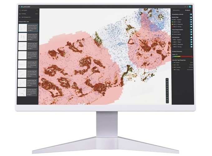 Image: Lunit SCOPE HER2 is an AI-powered solution designed to detect HER2 expression profile (Photo courtesy of Lunit)