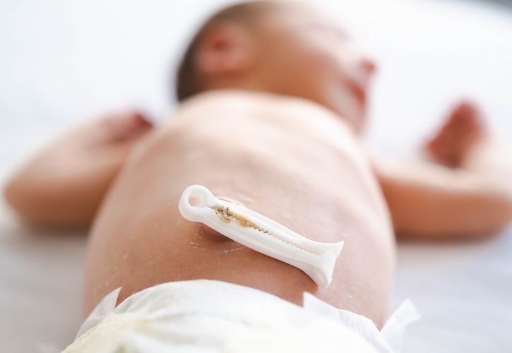 Image: Umbilical cord blood biomarkers may improve preterm infant care (Photo courtesy of Shutterstock)