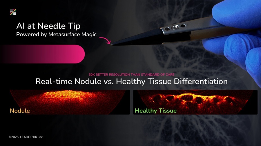 Image: Integration of optics and needle: intelligent optics (Photo courtesy of LEADOPTIK Inc)