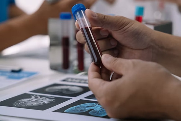 Image: A simple blood test could detect trauma-related illnesses (Photo courtesy of iXpressGenes)