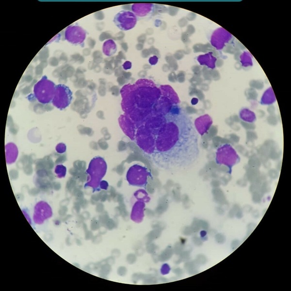 Image: The AI model accurately classifies pediatric sarcomas using digital pathology images alone (Photo courtesy of Shutterstock)