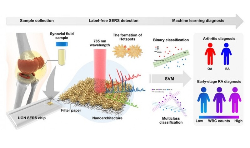 Image: The new technology uses body fluids for fast and differential diagnosis of arthritis (Photo courtesy of KIMS)