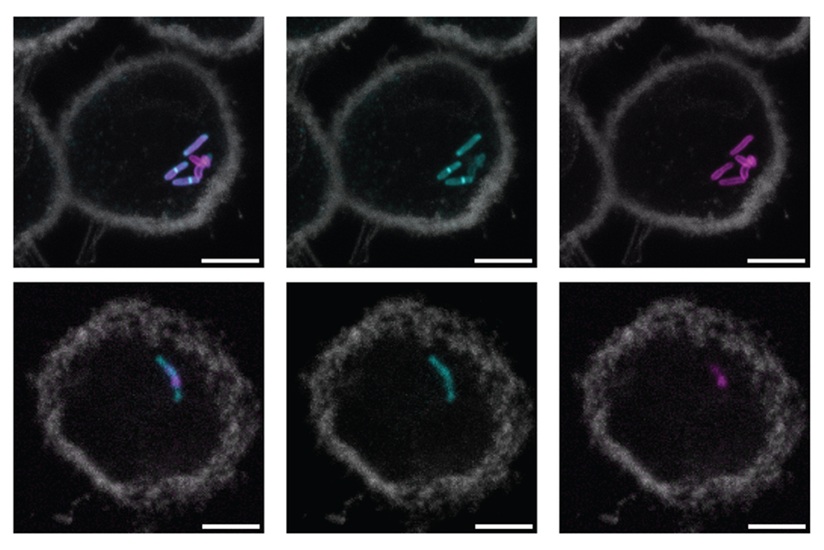 Image: Macrophages infected with mycobacterium tuberculosis (Photo courtesy of MIT)
