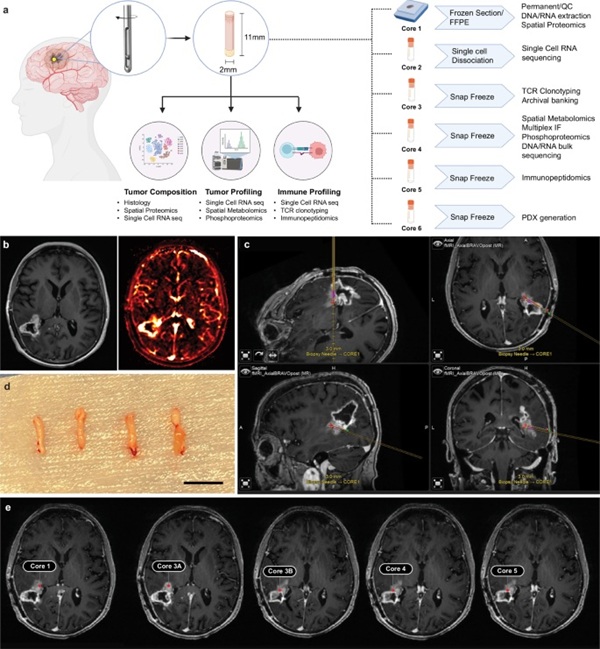 Image: Intra-operative collection and coordination of sample core distribution and analyses (Photo courtesy of Nature Communications)