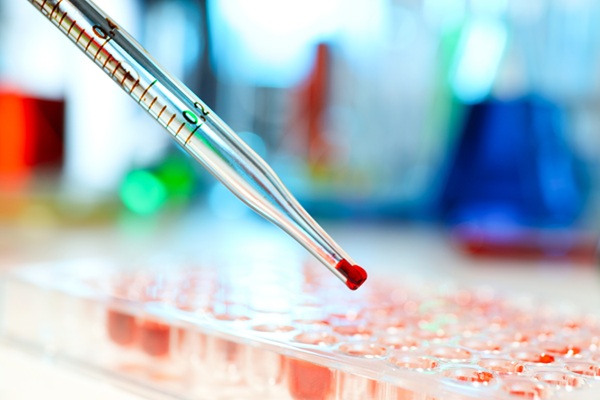 Image: The test is highly accurate in detecting HPV-associated head and neck cancers in both asymptomatic and symptomatic patients (Photo courtesy of 123RF)