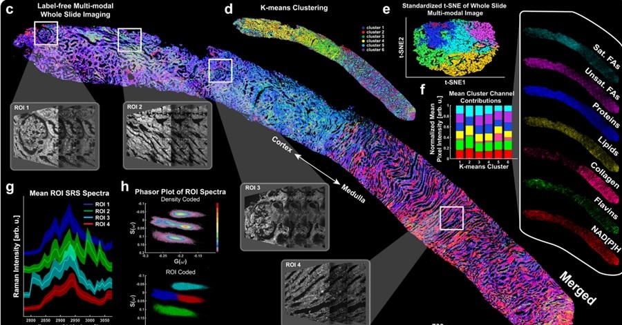 Image: A whole slide image of a renal core biopsy from a patient diagnosed with diabetic nephropathy imaged using the platform (Photo courtesy of Lingyan Shi lab/UC San Diego)
