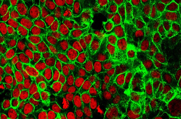 Image: A biomarker discovery pipeline has shown promise as a noninvasive method of diagnosing CRC (Photo courtesy of NCI Center for Cancer Research)