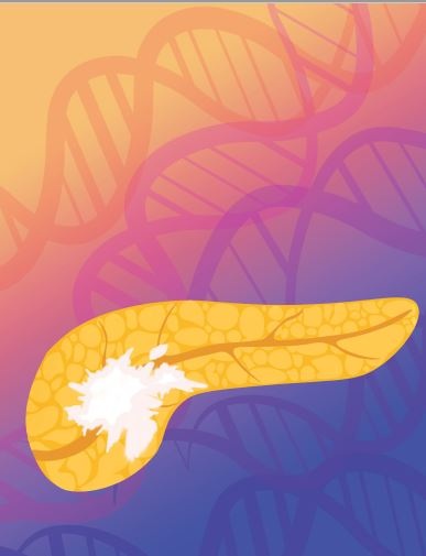 Image: Pancreatic tumor DNA in circulation can be used by novel AI blood test to determine response to cancer therapy (Photo courtesy of Carolyn Hruban)