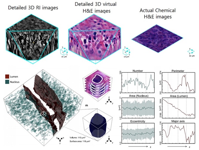 Image: Results of AI-based 3D virtual H&E staining and quantitative analysis of pathological tissue (Photo courtesy of Nature Communications, DOI:10.1038/s41467-025-59820-0)