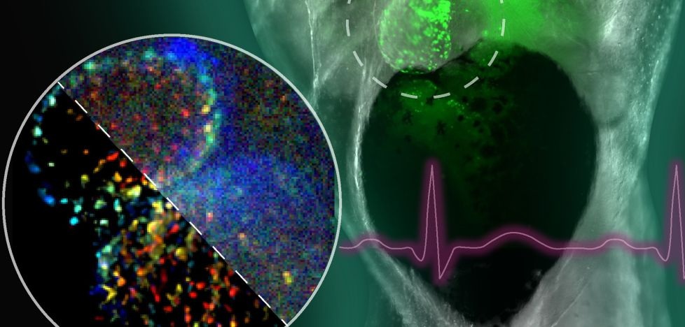 Image: The algorithm improves diagnosis of cardiovascular disease by enhancing visualization of cardiac tissue and vessels (Photo courtesy of Jia Shu/Georgia Institute of Technology)