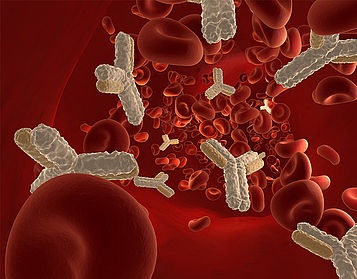 Image: The NVL antigen is now included in the EUROLINE Systemic Sclerosis Profile 2 (Photo courtesy of EUROIMMUN)