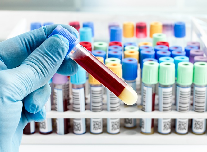 Image: The precision oncology test identifies patients most at risk of undergoing severe toxicity from treatment with 5FU/capecitabine (Photo courtesy of 123RF)