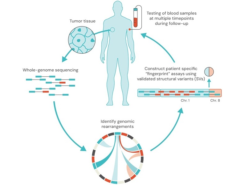 Image: Pathlight is a tumor-informed, multi-cancer MRD platform with its first indication in breast cancer (Photo courtesy of SAGA Diagnostics)