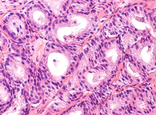 Image: The machine learning-based method delivers near-perfect survival estimates for PAC patients (Photo courtesy of Shutterstock)