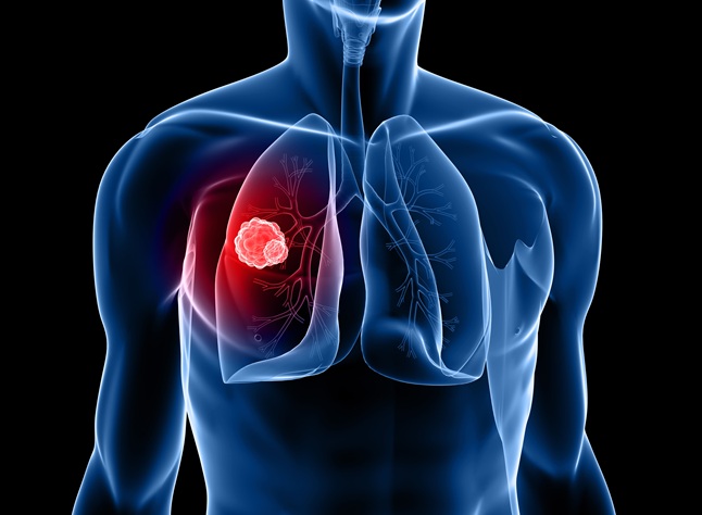 Image: NHS is the first in the world to roll out a revolutionary blood test for cancer patients (Photo courtesy of Adobe Stock)