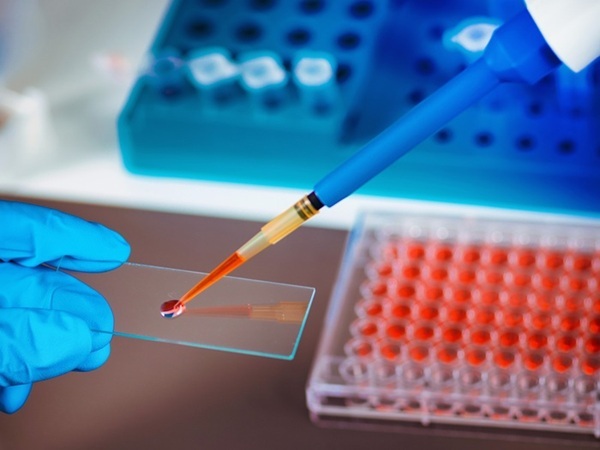 Image: Cancers can be detected in the bloodstream prior to clinical signs or symptoms (Photo courtesy of 123RF)