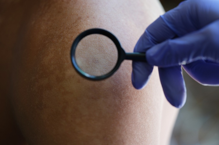 Image: New research has linked skin barrier dysfunction to pediatric eosinophilic esophagitis (Photo courtesy of 123RF)