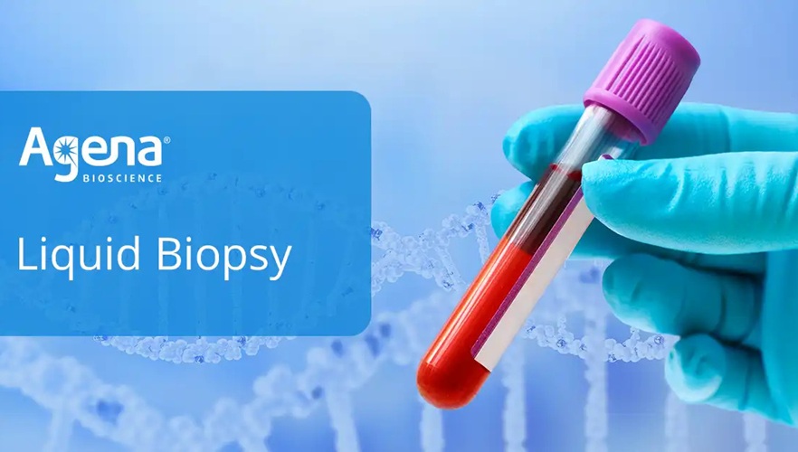 Image: The UltraSEEK liquid biopsy lung panel detects variants in NSCLC cfDNA samples (Photo courtesy of Agena Bioscience)