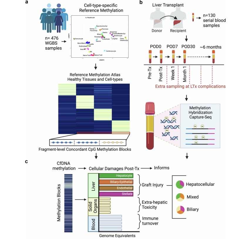Image: Study overview using cell-free DNA methylation patterns in blood to monitor cellular damages after liver transplant (Photo courtesy of Nature Communications)