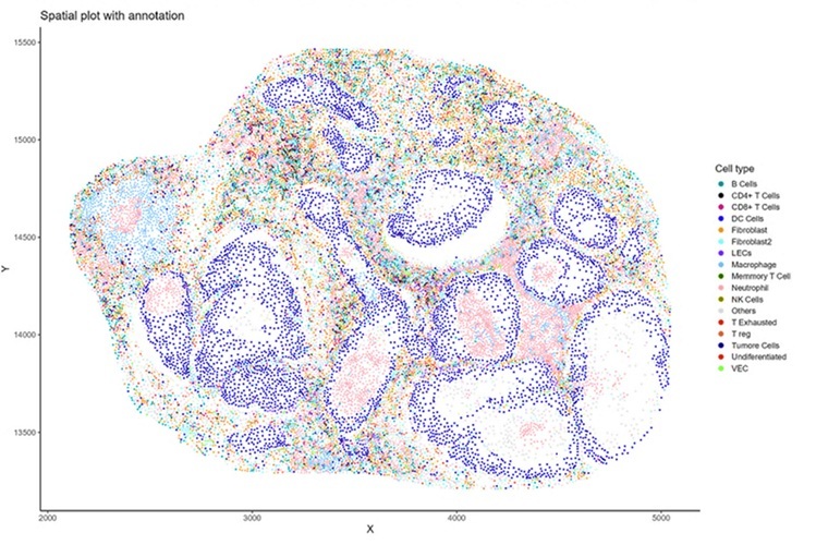 Image: The new tool uses advanced computer models to identify different kinds of cells in tissues faster and more accurately (Photo courtesy of VCU)
