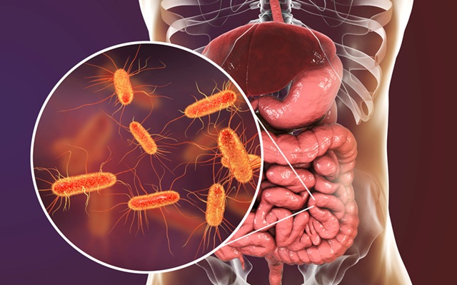 Image: Critically ill patients have reduced intestinal microbiota diversity and altered microbiome-associated metabolite concentrations (Photo courtesy of 123RF)