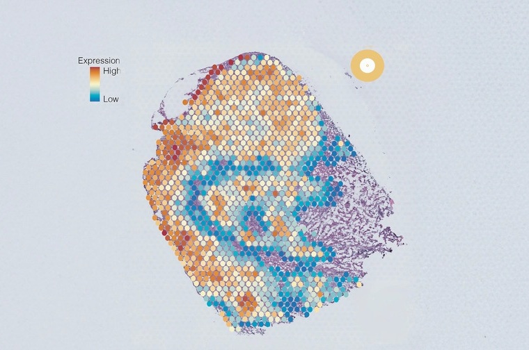 Image: The AI tool is set to transform the characterization and treatment of cancers (Photo courtesy of Garvan Institute)
