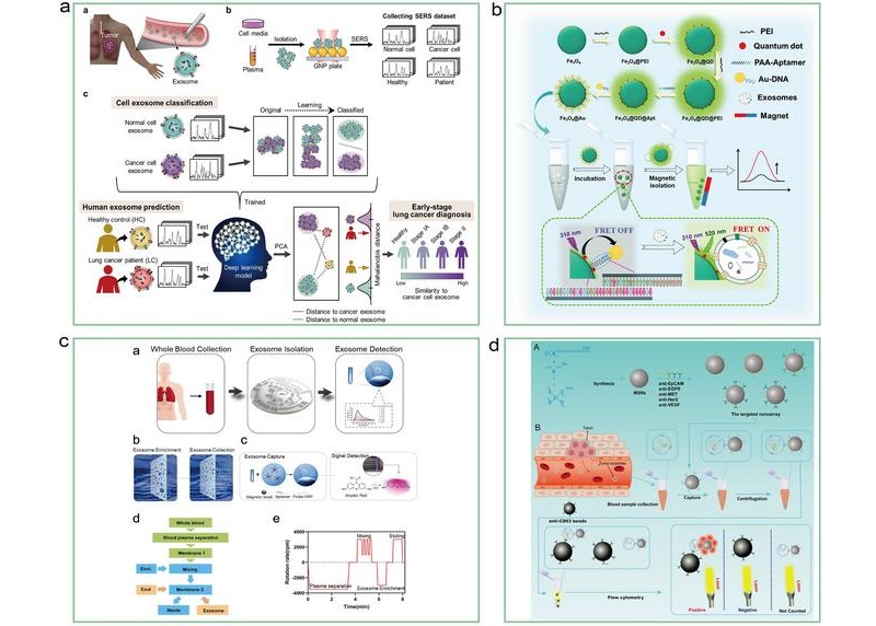 Image: Schematic overview of the deep learning-based circulating exosome analysis for lung cancer detection (Photo courtesy of Chuan Xu, Cheng Jiang)