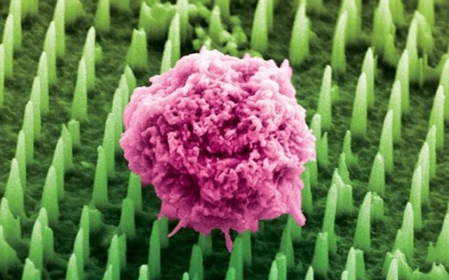 Image: Tens of millions of nanoneedles could replace painful cancer biopsies (Photo courtesy of KCL)