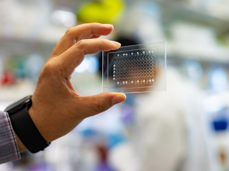 Image: The new handheld TB testing device significantly improves disease detection in HIV patients (Photo courtesy of Vincent Postle/Tulane University)