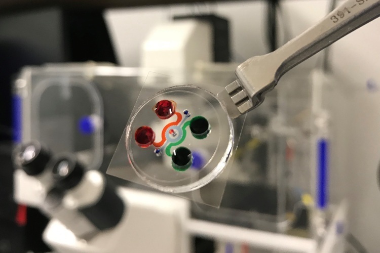 Image: The actual chip of human leukemia bone marrow where chambers and channels were filled with food dyes (Photo courtesy of Weiqiang Chen/NYU Tandon Applied Micro-Bioengineering Laboratory)