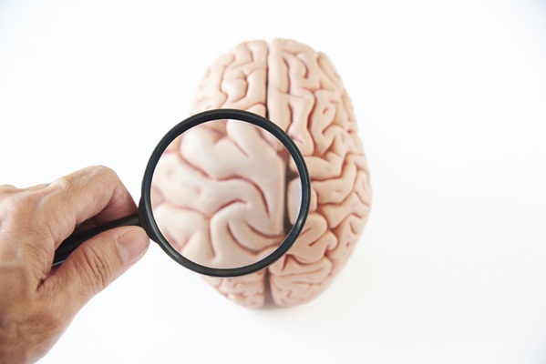 Image: Increased polysialic acid in schizophrenia patients represents a potential diagnostic tool and possible target for treatment (Photo courtesy of 123RF)