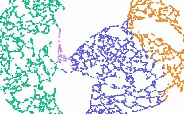 Image: The RNA-seq based diagnostic test for pediatric leukemia ensures better outcomes for children with this common cancer (Photo courtesy of Qlucore)