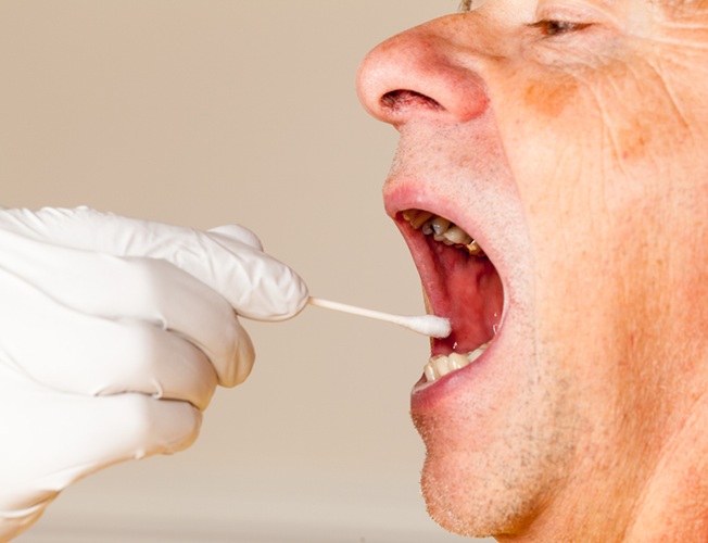Image: A salivary enzyme could predict susceptibility Type 2 diabetes (Courtesy of 123RF)