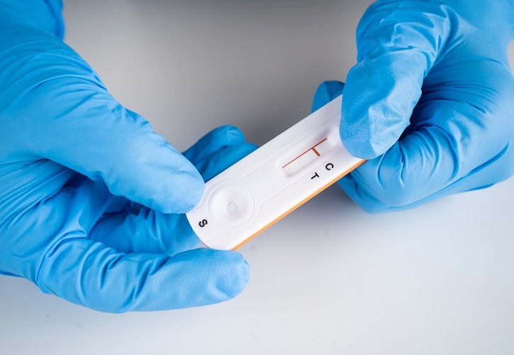 Image: Combining rapid diagnostic tests with conventional serology proves to be a useful strategy for diagnosing Chagas disease (Courtesy of Adobe Stock)