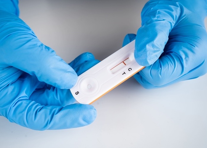 Image: Combining rapid diagnostic tests with conventional serology proves to be a useful strategy for diagnosing Chagas disease (Courtesy of Adobe Stock)