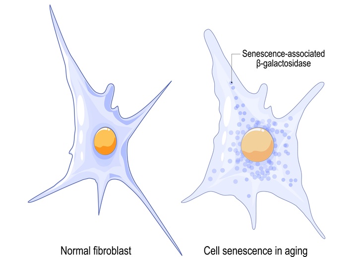 Image: A tool uses artificial intelligence and high-resolution imaging to track senescent cells (Courtesy of Adobe Stock)